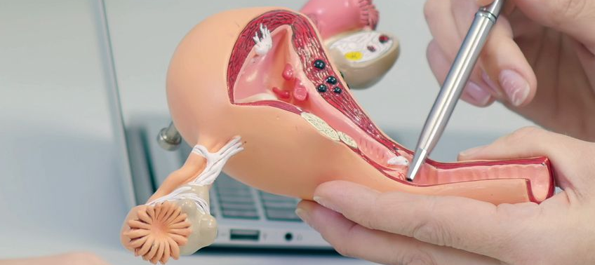 Exploratory Laparotomy in Kanpur