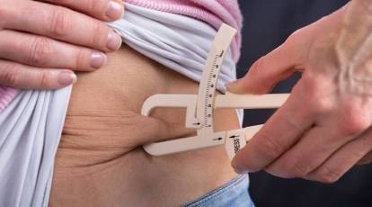 Bariatric surgery