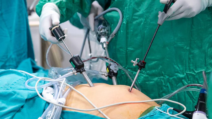 Bariatric surgery